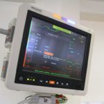 monitor-functii-vitale_3